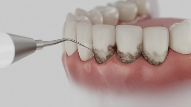Reliable Dental contractor in Martinsville, IL by Dentist Open Now